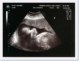September - Sara Ultrasound - (1) * 1078 x 827 * (1.14MB)